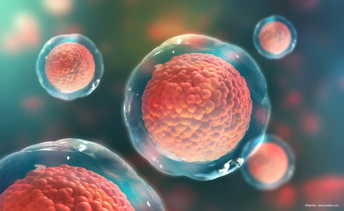 What is encapsulated cell therapy?