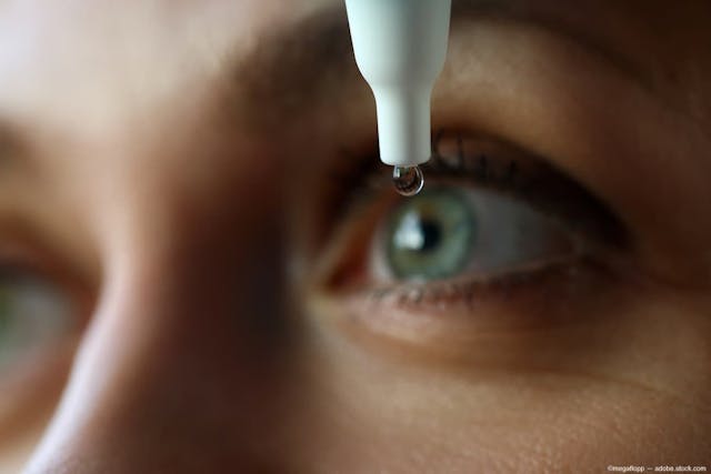 Phase Ib/IIa trial of EXN407 eye drops from Exonate demonstrates safety and tolerability 