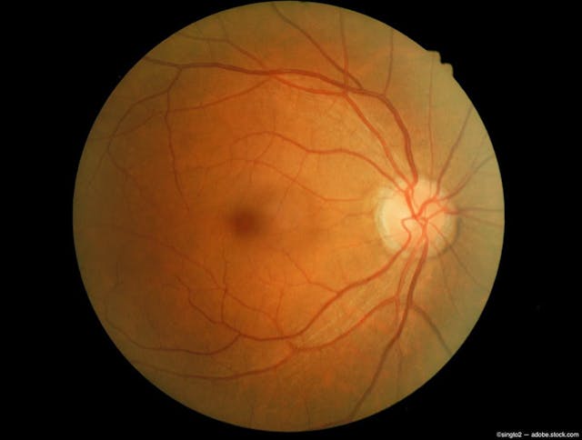 Retinal vascular health: 4 insights ophthalmologists should keep top of mind