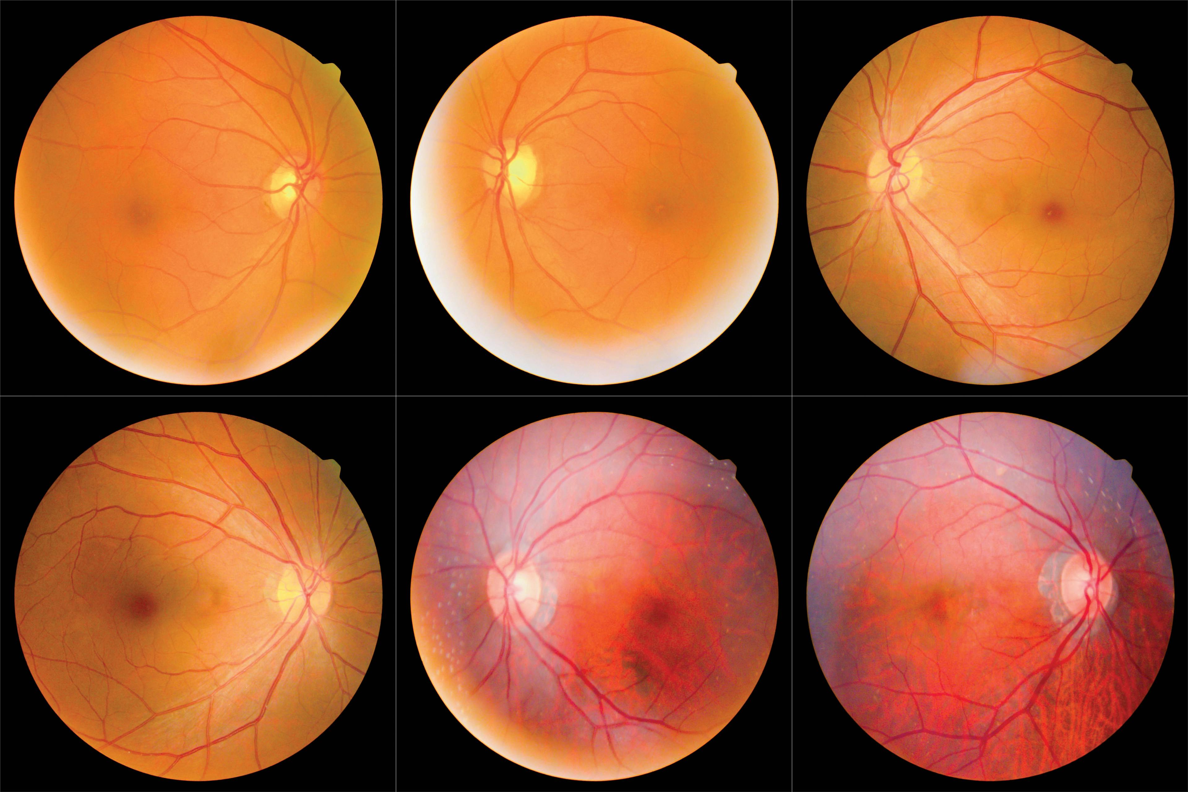 Casting a new light on fundus imaging