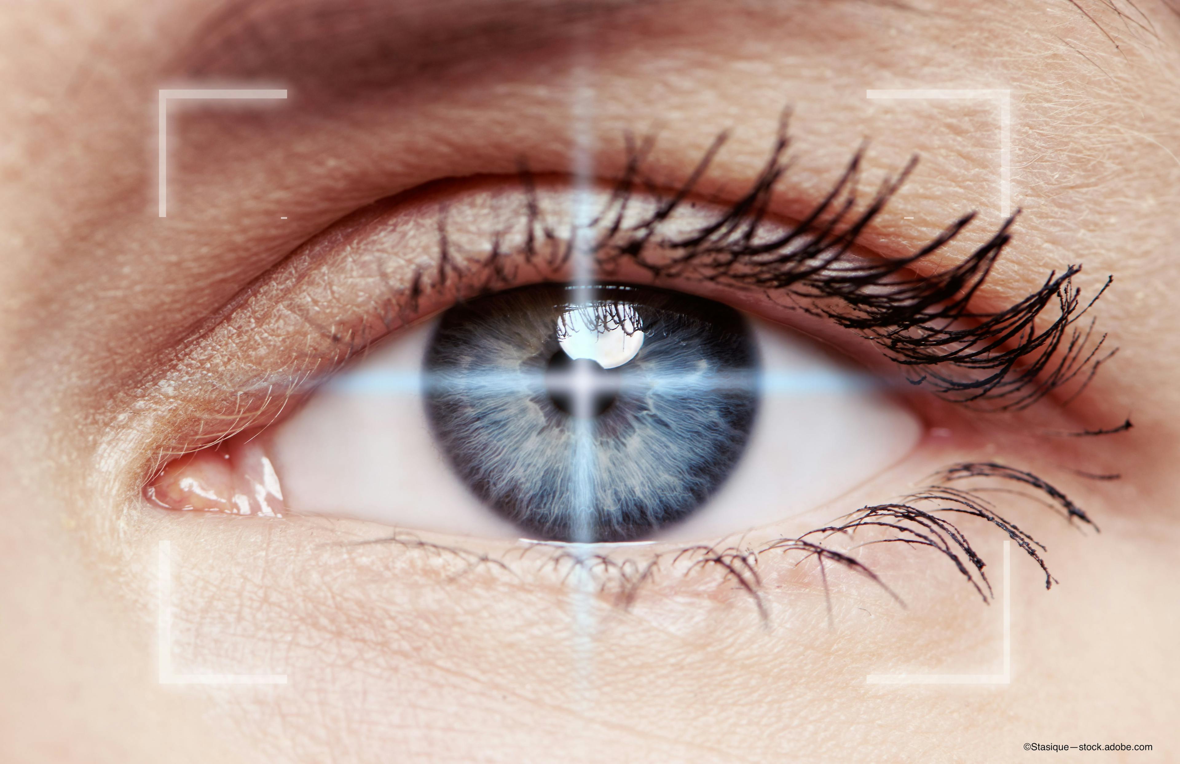 Laser imaging system may offer early detection, treatment for eye diseases that cause blindness