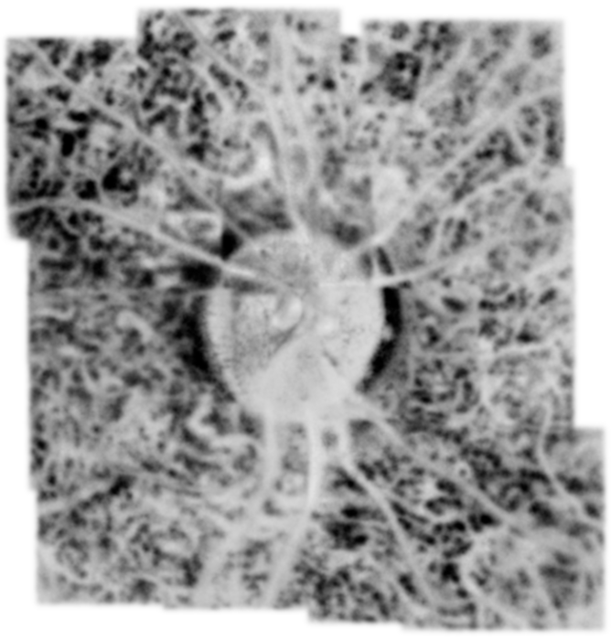 Image of a selected layer in the human choroid obtained by the new STOC-T method.(Image courtesy of IPCPAS/ICTER)