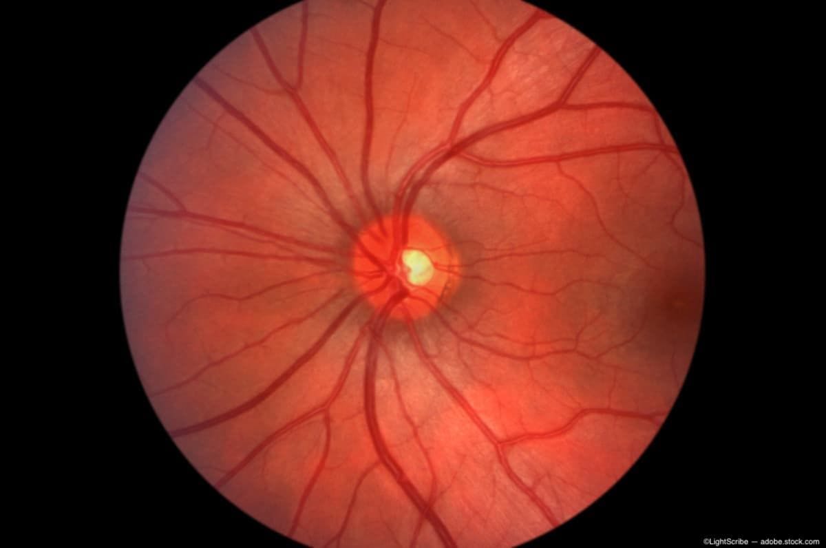 Novel protocol to rapidly diagnose and treat retinal artery occlusion
