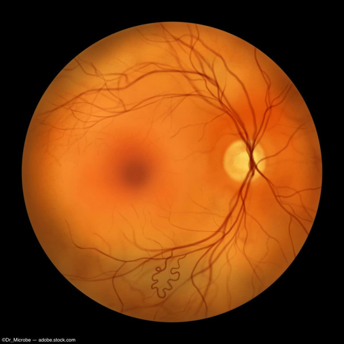 OCT image of retinal vascular structure Image credit: AdobeStock/Dr_Microbe