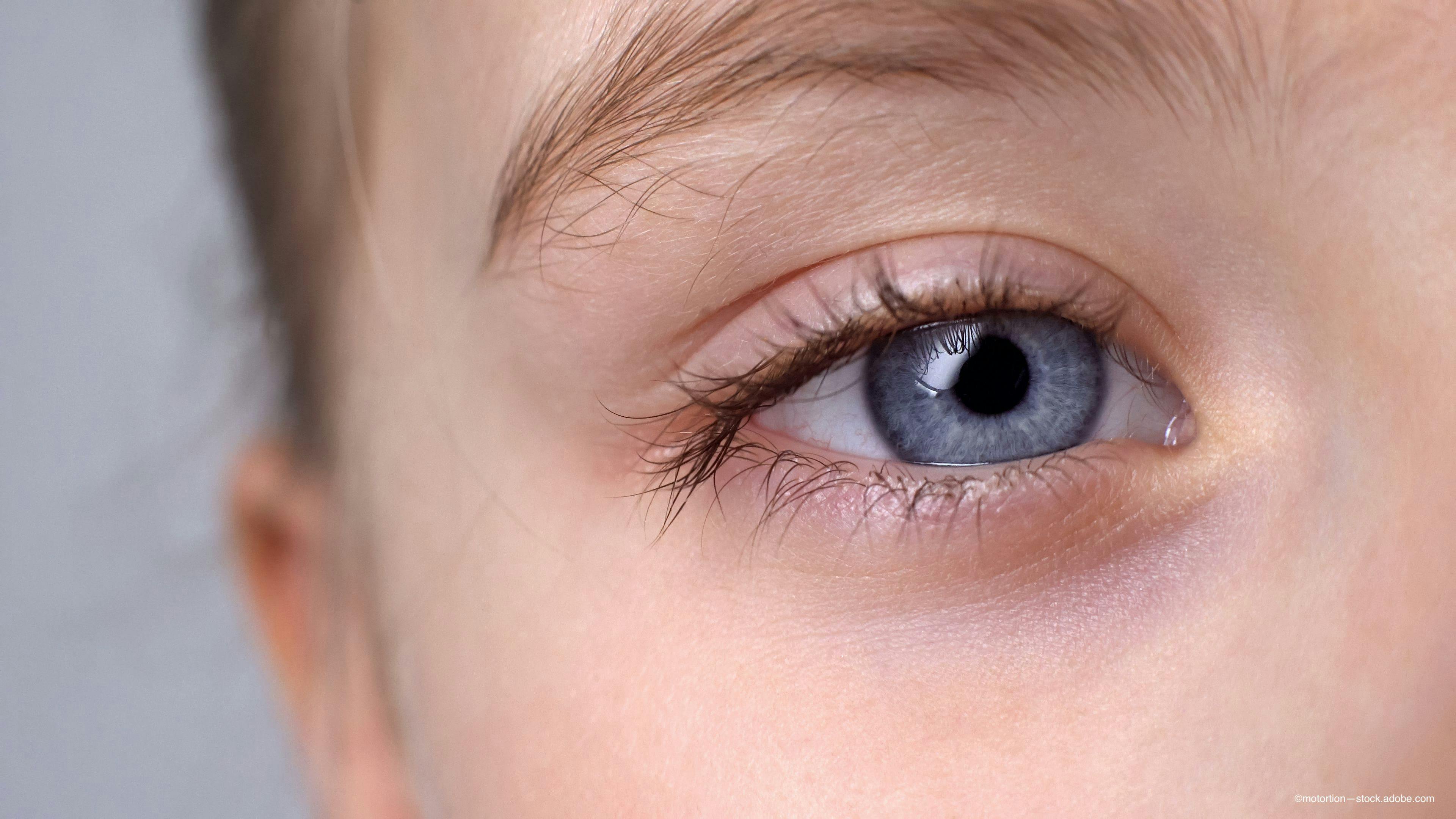 Pediatric ophthalmologists target inherited retinal diseases