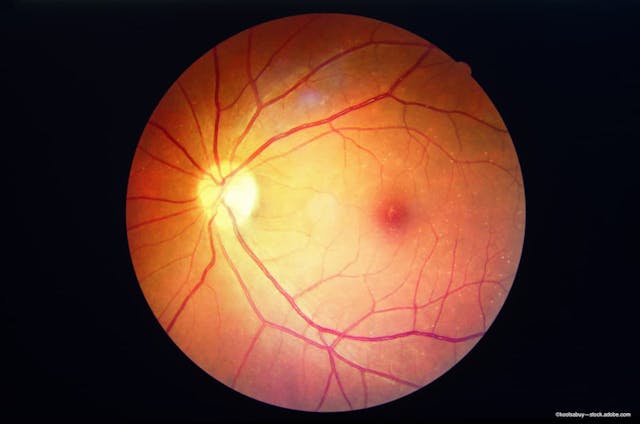 This week in retina: October 29-November 3