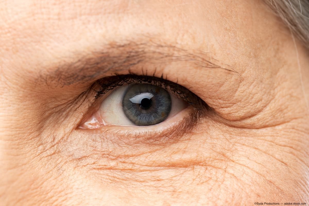 Understanding the risks: 4 factors that may contribute to AMD