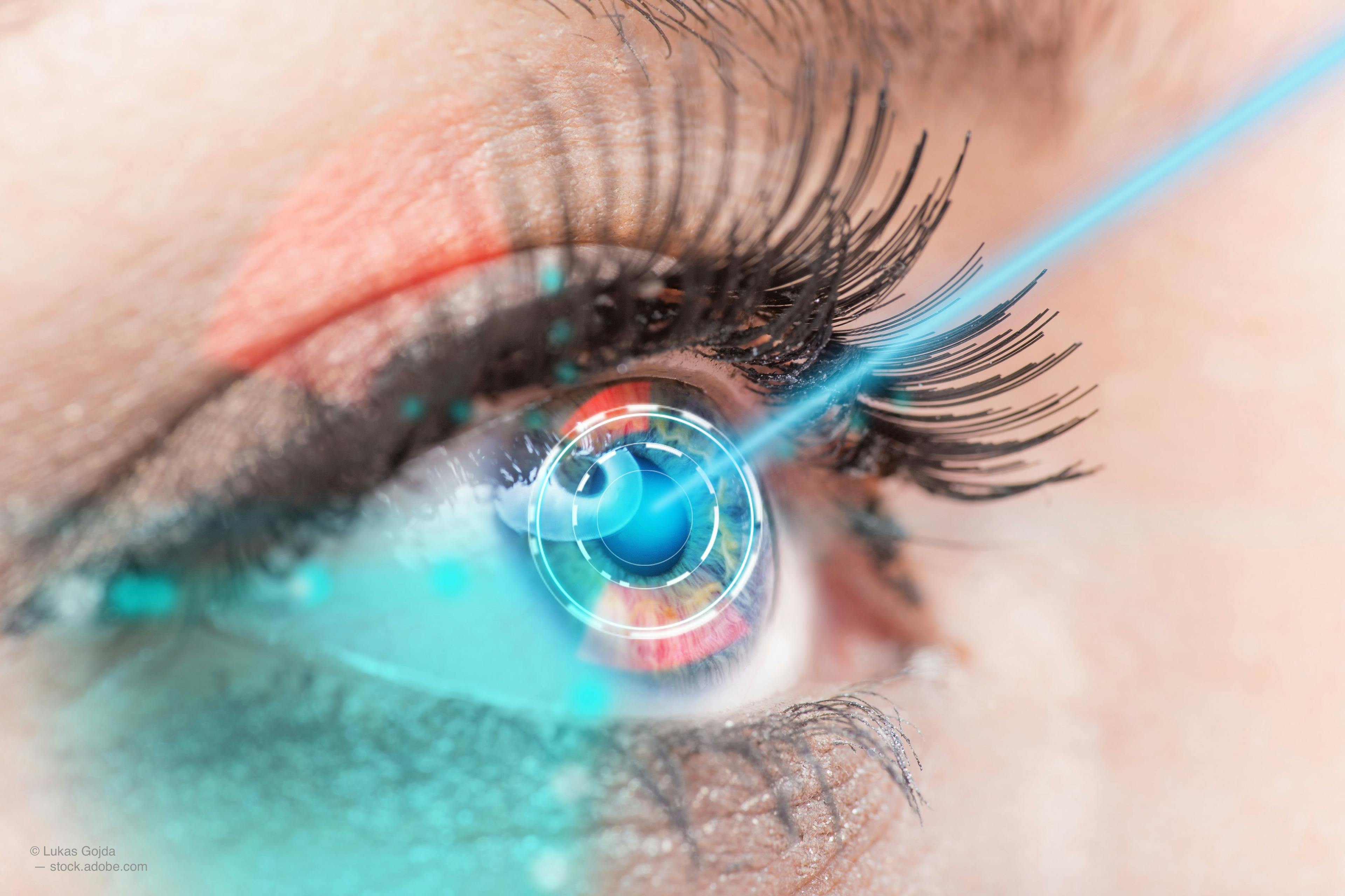  Prof. Ben Burton detailed how dry AMD patients treated with photobiomodulation therapy have seen improvements in best-corrected visual acuity 9 months after treatment. 