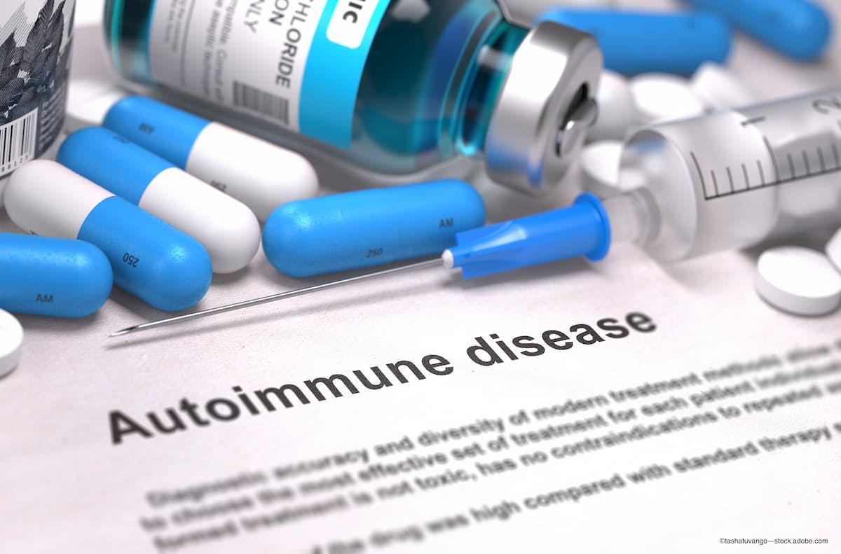 Autoimmune disease and the eye: Current thinking and approaches to treatment