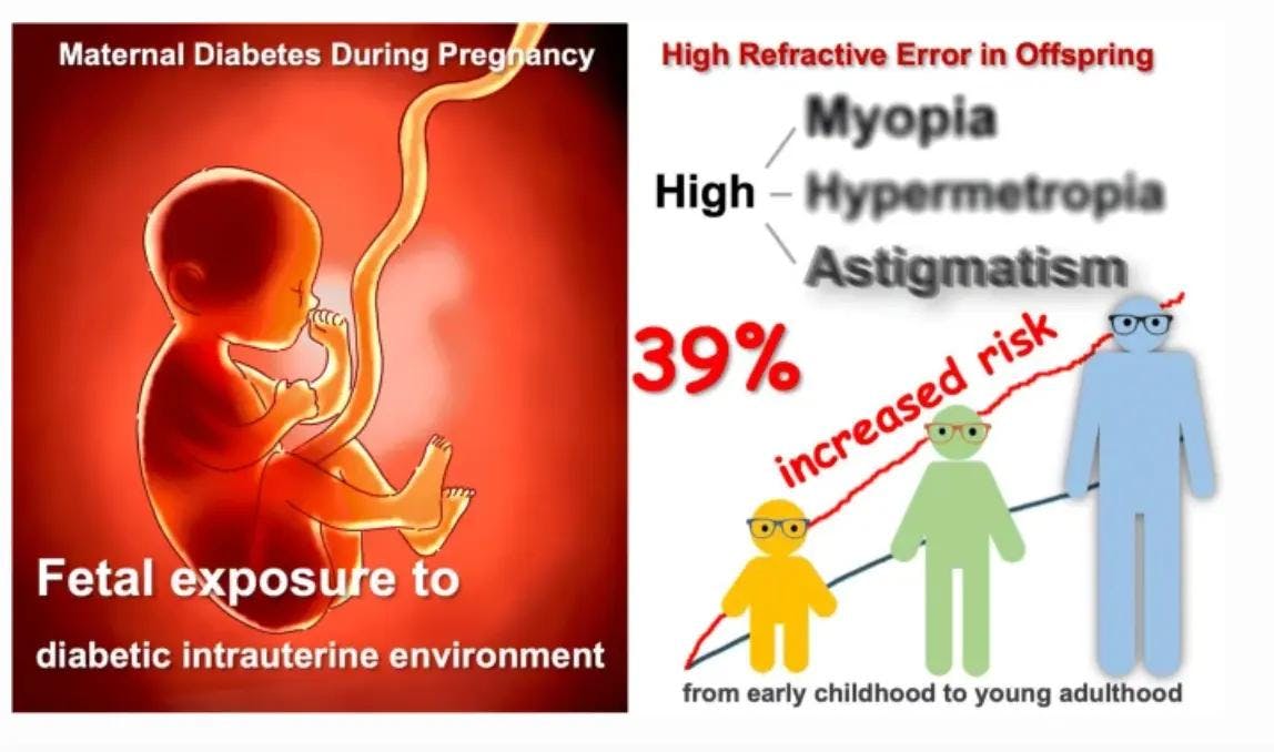 Maternal diabetes during pregnancy, fetal exposure to diabetic intrauterine environment linked to refractive error in offspring