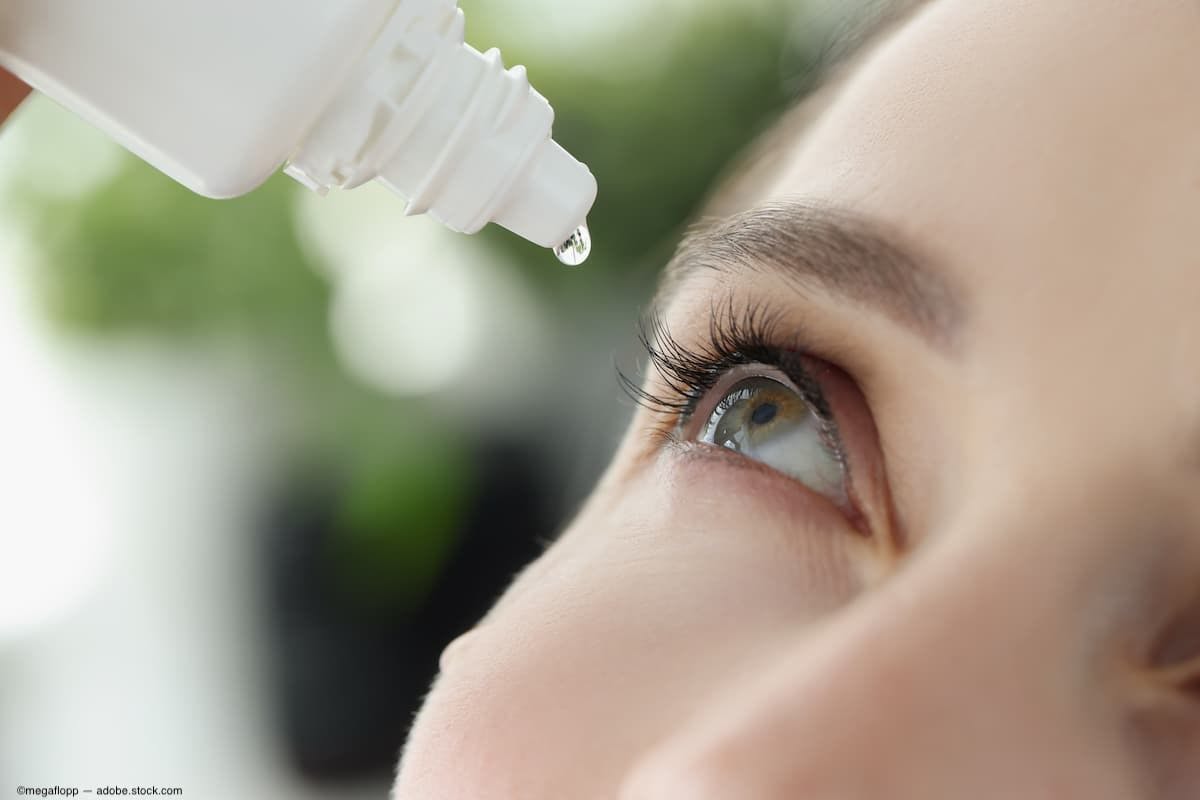 Woman using a bottle of eye drops (Image credit: AdobeStock/megaflopp)