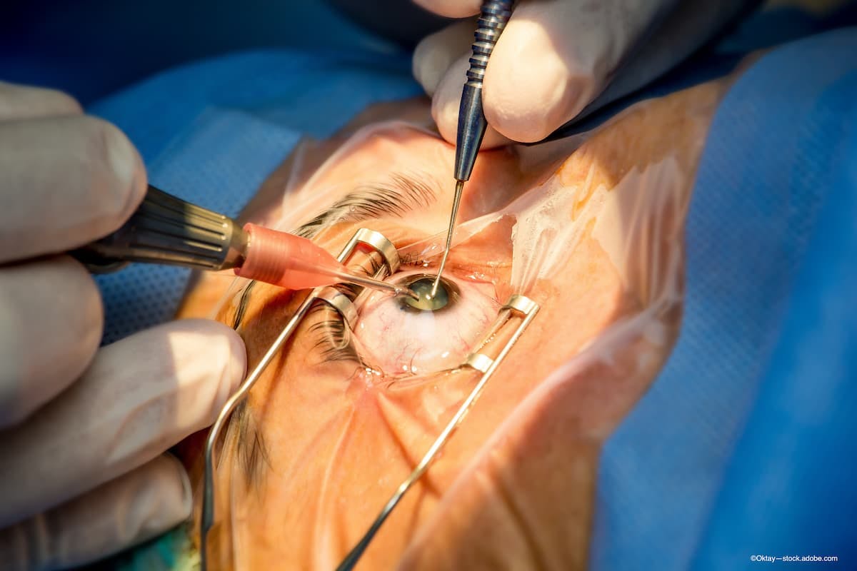 Diabetic retinopathy's effect on early visual outcomes after cataract surgery