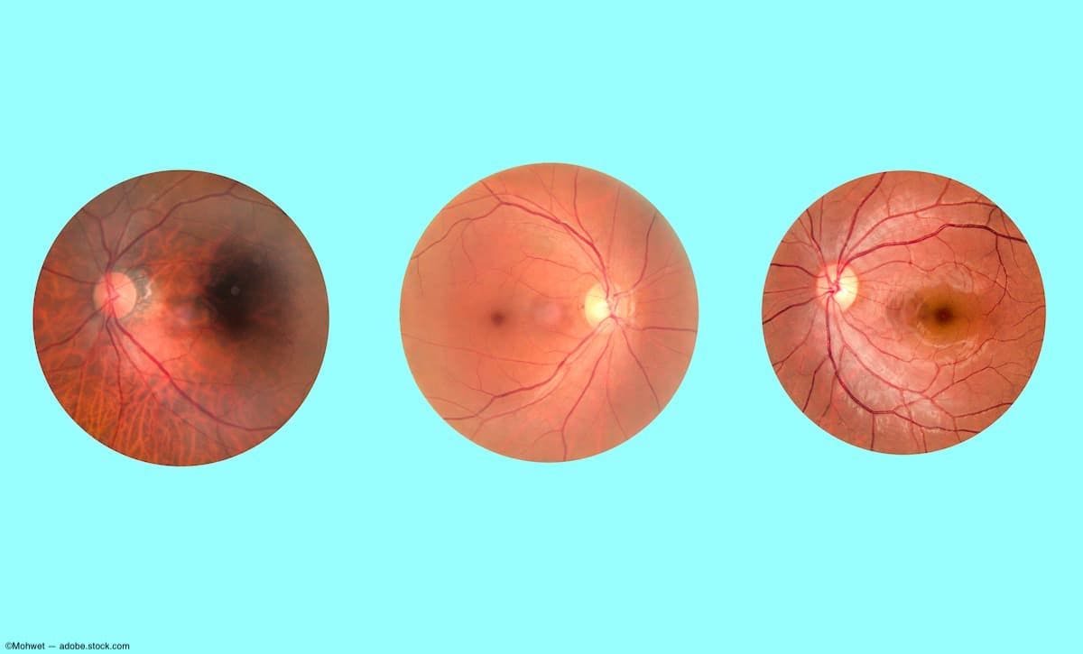 Predicting systemic diseases from ocular fundus images