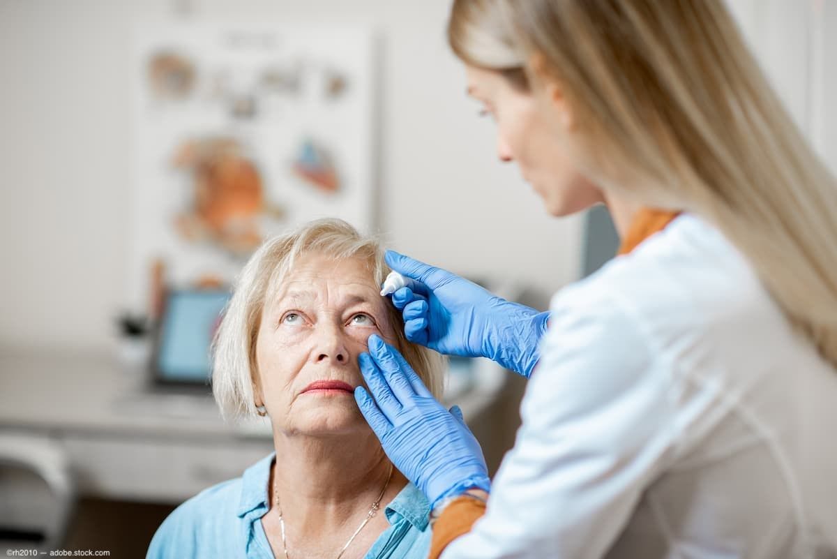 Woman doctor applying eye drops to a patient (Image credit: AdobeStock/rh2010)
