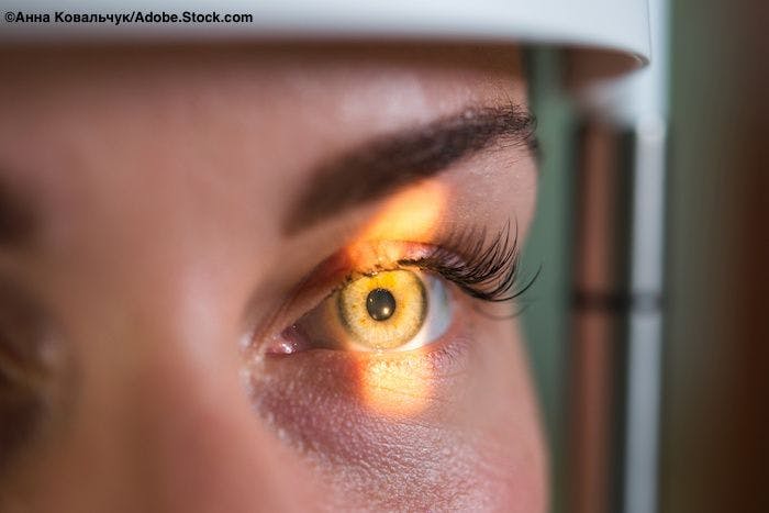 Adalimumab therapy safe, effective in real-world, open-label uveitis study