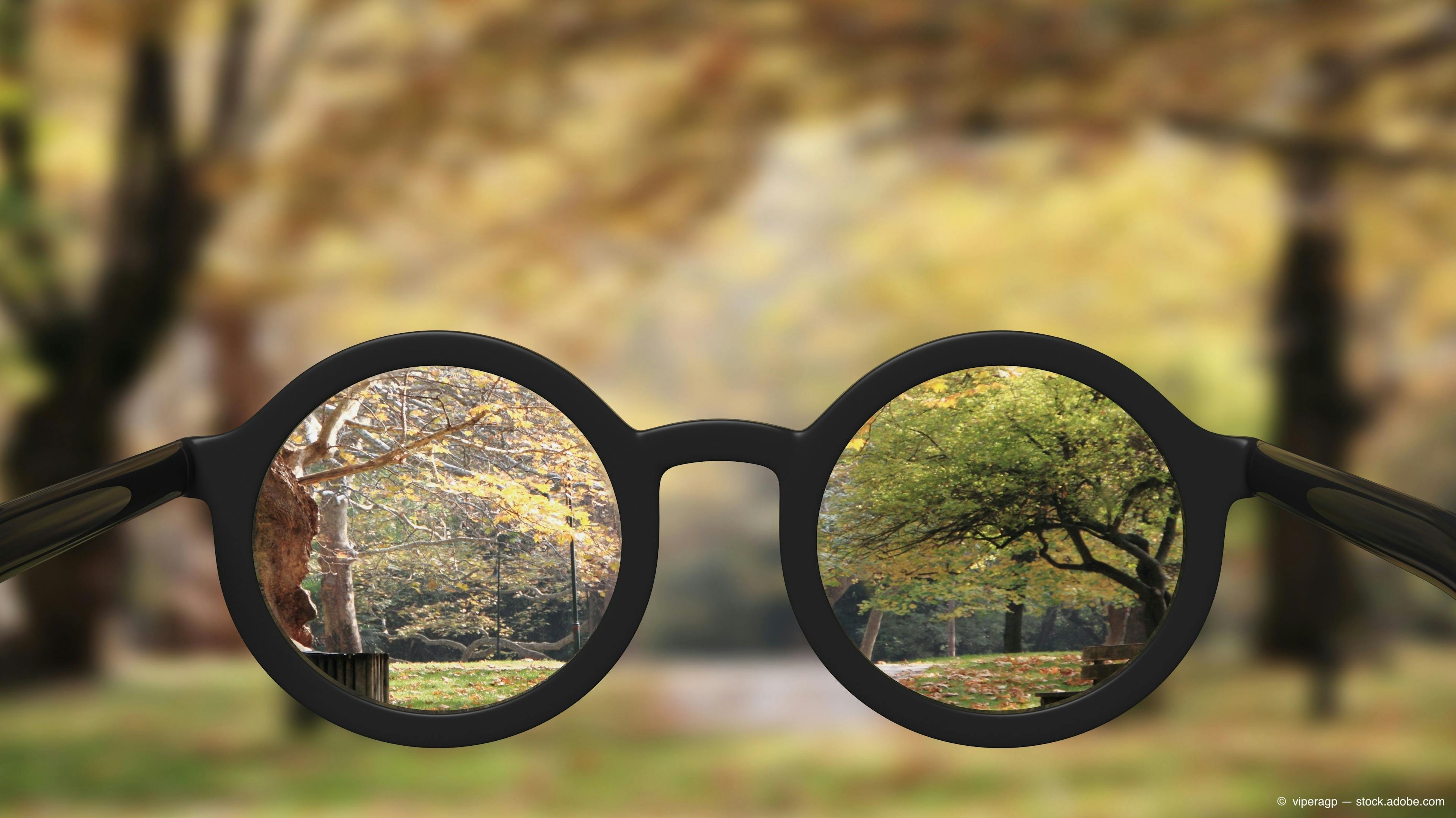 AAO 2020: Myopia progression slowed with multifocal and orthokeratology lenses 