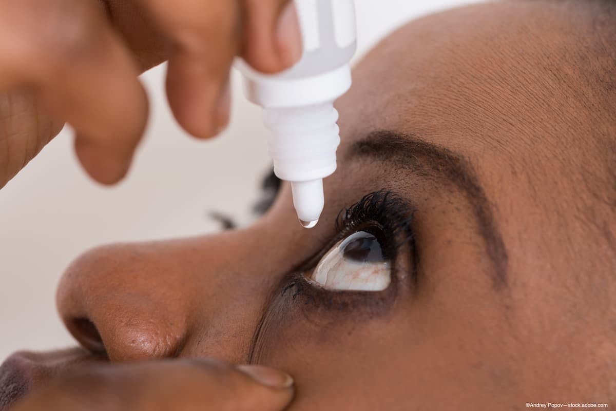 FDA approves generic solution of cyclosporine ophthalmic emulsion for dry eye