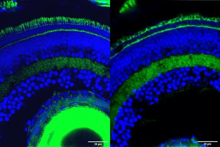 Gene fragments revealed play crucial role in retinal development and vision