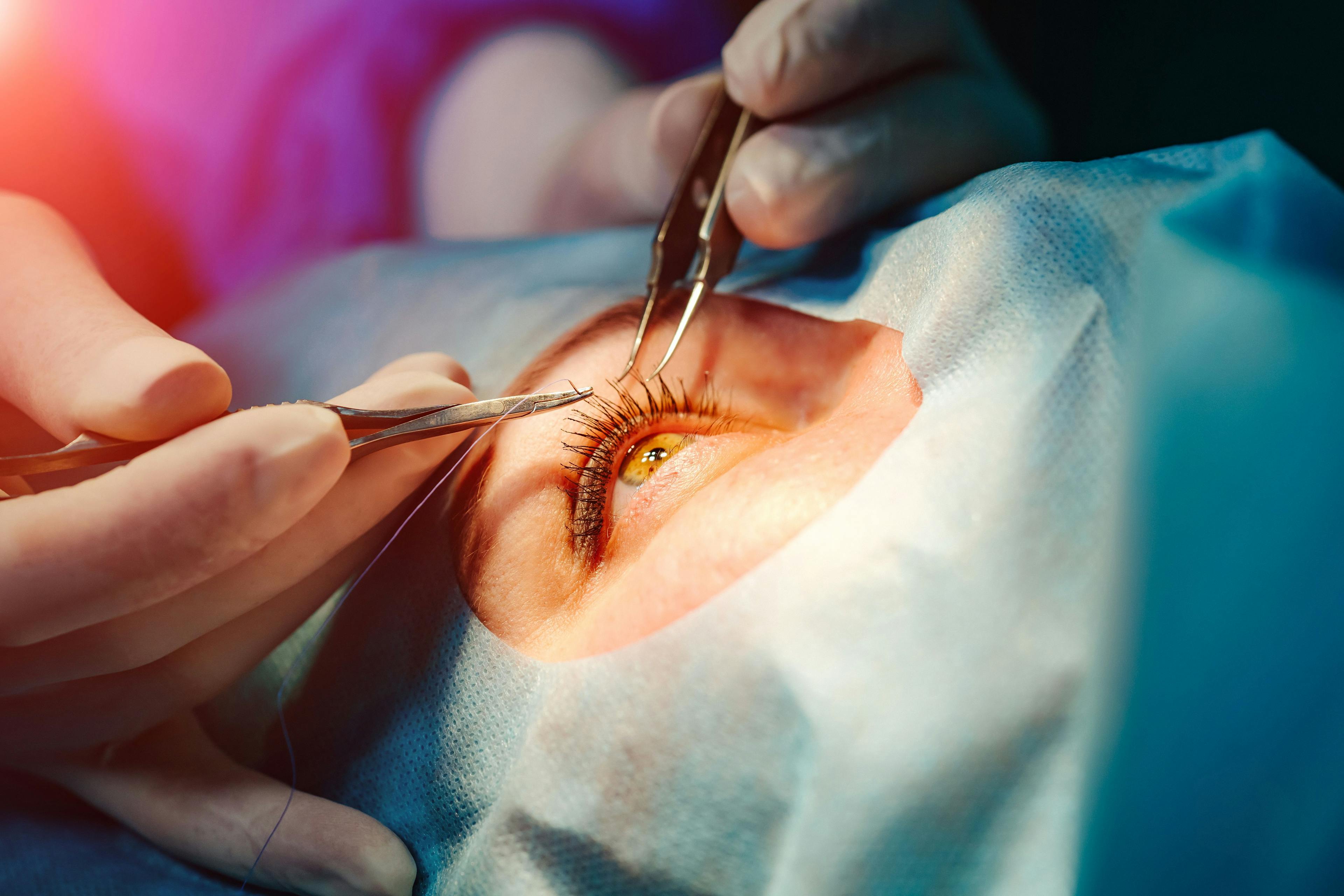Study: Black and Hispanic patients treated for retinal detachment with surgery had worse vision results than white patients 