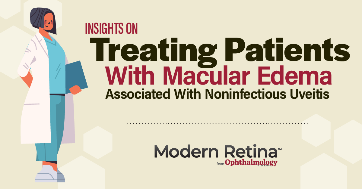 Insights on Treating Patients with Macular Edema Associated with Noninfectious Uveitis