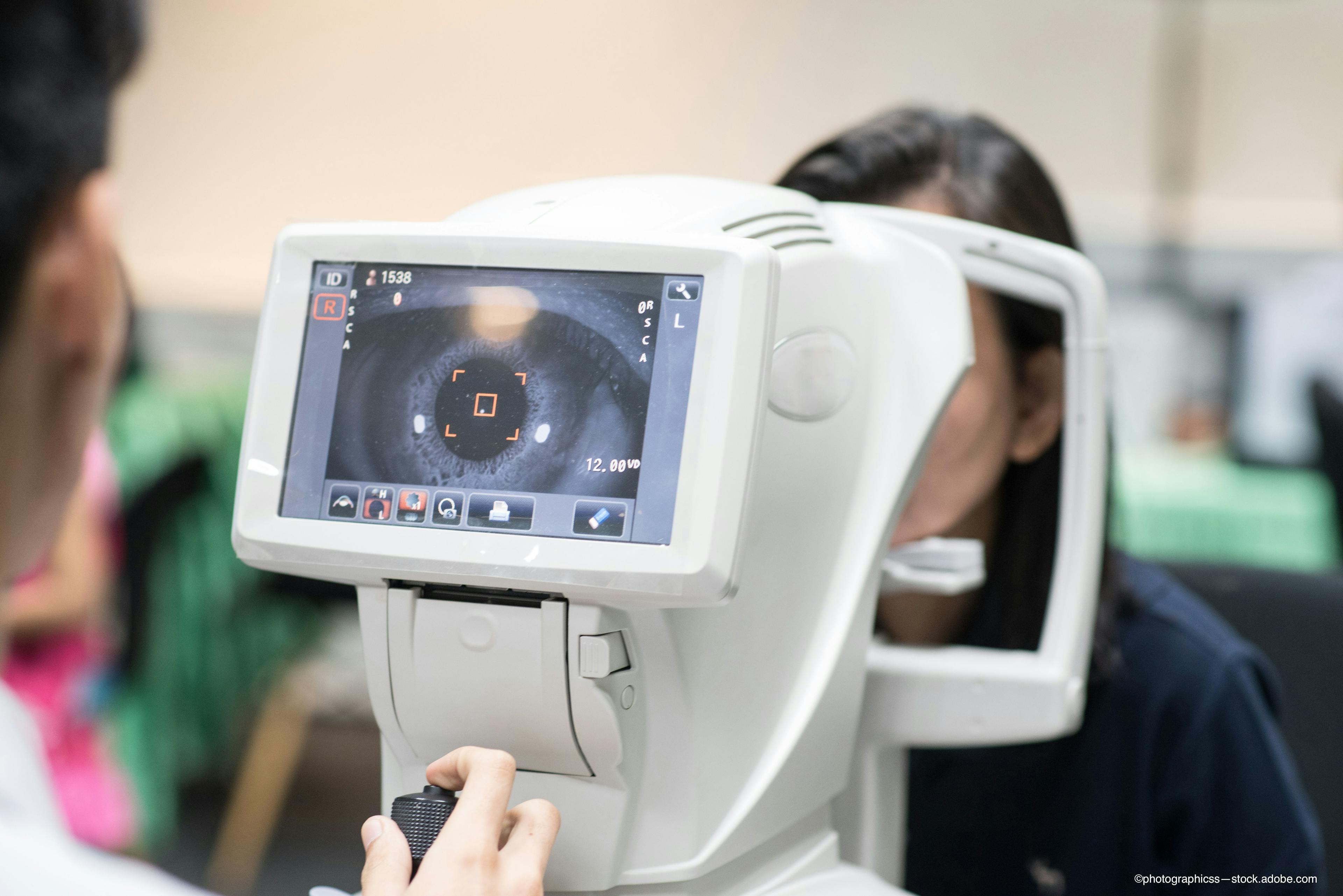 Measuring intraocular inflammation with standard care imaging