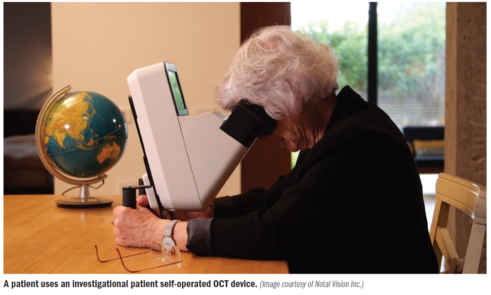A patient uses an investigational self-operated OCT device. 