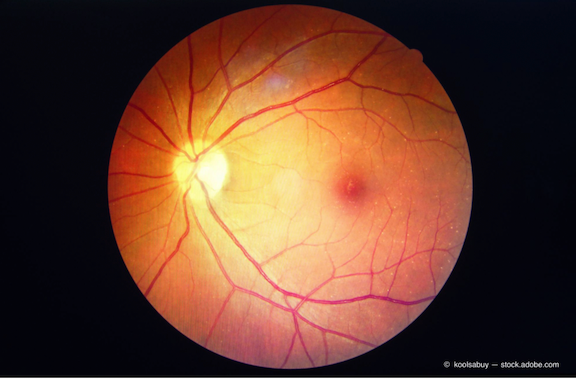Casting light on diabetic eye disease: Better understanding is key to prevention