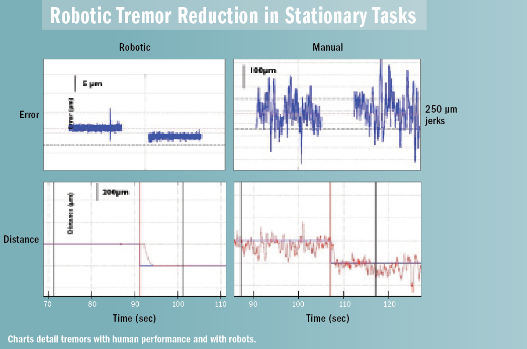 robotic tremors
